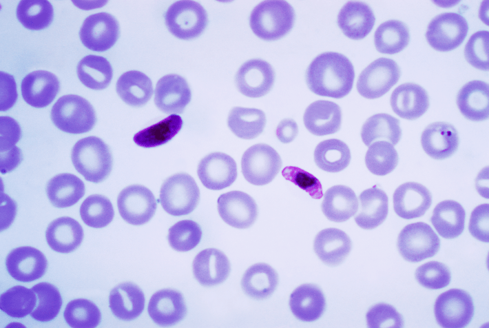 Plasmodium falciparum parasite a macro and microgametocyte